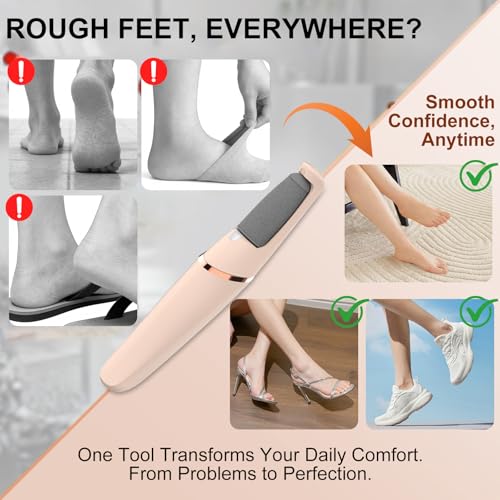 Electric Foot File Callus Remover for Feet Rechargeable & WaterSafe