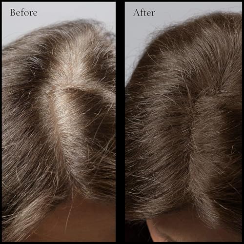 NuBeauti Medium Brown Root Concealer Powder for Gray Hair Touch Up - All-Natural Mineral Formula