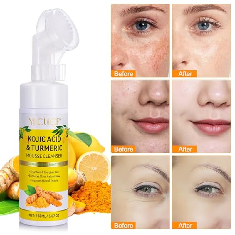 2 Pack Turmeric Cleansing Mousse,Kojic Acid Facial Cleanser for Fce Wash and Firming Skin,Remove Excess Keratin-Deep Clean Pores 150ML