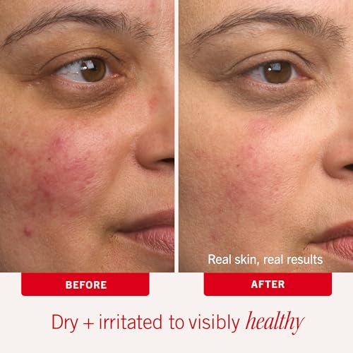 First Aid Beauty - Ultra Repair Cream - Intense Hydration Face & Body Moisturizer - Whipped Colloidal Oatmeal Clinically Proven to Strengthen Skin Barrier in 7 Days - Helps Relieve Eczema, 4 oz