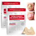 Fungal Nail Patches 76 Count for Toenail Renewal - Deep Root Care & Long-Lasting Fit