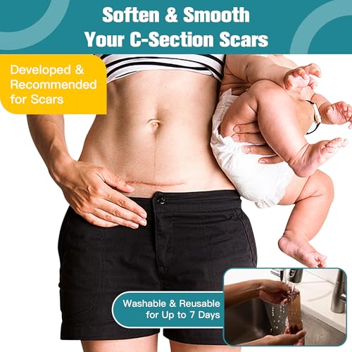 Silicone Scar Thicked Sheets,C Section Recovery Kit 2in x 8in 10ct | Reuseable Extra Long Scar Strips for Reducing the Appearance of Keloid Bump,Stretch Marks,Burn,Surgical Scar Removal(Latex Free)