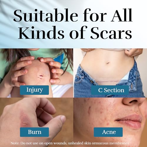 Silicone Scar Cream, Scar Treatment for Improves Skin Texture & Helps Remove Acne, Stretch Marks, Surgery, C Section, Burn, Keloid & Hypertrophic Scars 1.76 Oz (50g)