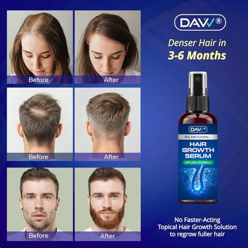 DAVV 4 Fl Oz Minoxidil Spray for Women & Men Hair Growth - 5% Support