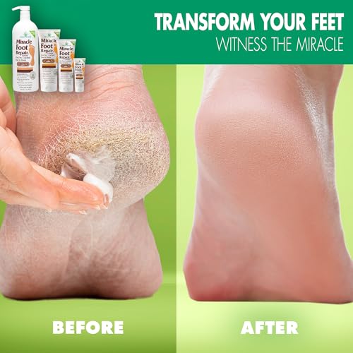 Miracle Foot Repair Cream, 4 oz Repairs Dry Cracked Heels and Feet, Diabetic-Safe, 60% Pure Ultra Aloe Moisturizes, Softens, and Repairs, Relief from Discomfort of Ingrown Toenails (2-Pack)