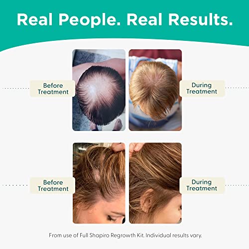 Vegan Hair Loss Shampoo for Thinning Hair - 8 Fl Oz - DHT Blocker, Sulfate-Free, Safe for Men & Women