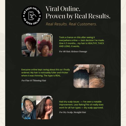 Glossed By Nae Voodoo Hair Growth Oil - Rosemary, Lemongrass & Castor Oil - All Hair Types - 4 Fl Oz - Variation 1