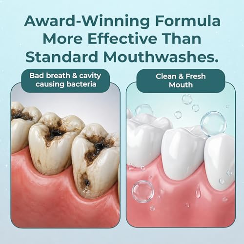 Anticavity Fluoride Mouthwash with Molecular Iodine - Mint, 33.8 oz