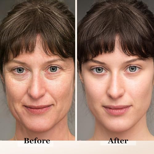 Retinol Face & Neck Cream - Anti-Aging Moisturizer with Collagen & Hyaluronic Acid, 1.7oz