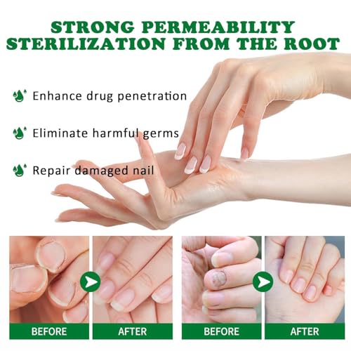 Exfoliating Foot Peel Mask with AHA/BHA & 4 Fruit Extracts ? Removes Dead Skin & Calluses for Baby Soft Feet ? Foot Peeling Mask Socks for Dry, Cracked Feet (4 Pairs)