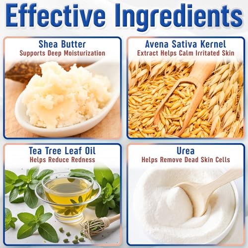 Marie's Original Acne Bar Soap Cleanser for Face and Body | Acne Treatment with Bentonite Clay, Organic Oat Bran, Noni Fruit Powder, White Willow | Natural Body Wash for Pimples and Scars (1 Pack)