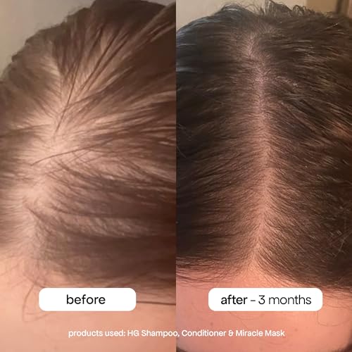 Bondiboost HG Anti-Thinning Shampoo - 16.9 Fl Oz for Thinning Hair - Men & Women