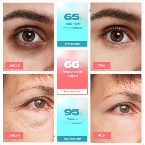 Red Light Therapy for Eye Bags, Dark Circles & Puffiness - Red Light Therapy Device with 630 NM 36 Leds - 3 Modes Red Light & Massager Mode, 10 Min Auto Timer, Rechargeable
