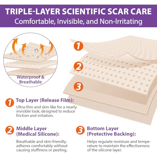 Silicone Scar Sheets, Silicone Sheets for Scars, Silicone Scar Tape for Surgical Scars, Medical Grade Scar Tape for Acne Scar Treatment, Stretch Marks, Tummy Tuck (1.6¡±x 60¡±), Roll-1.5M