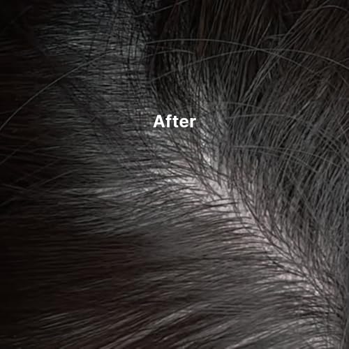 Kelp Scalp Serum Hydrating Treatment for Dry & Itchy Scalp - Natural Hair Growth