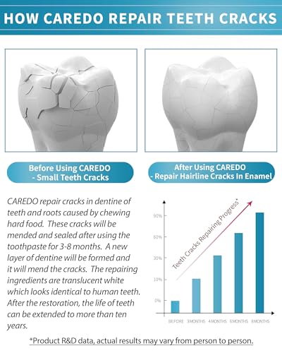 Healing Teeth Crack Toothpaste - Repair & Remineralize Enamel, 3.52oz Pack of 1 - Cracked Teeth Care