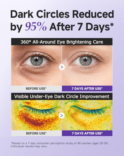 Under Eye Cream for Dark Circles & Wrinkles with Niacinamide - Brightening & Hydrating