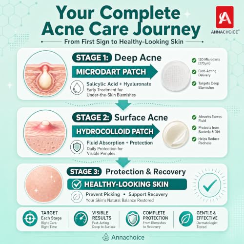 Acne Patch Kit with Microdart & Hydrocolloid - 368 Count – Complete Acne Care System