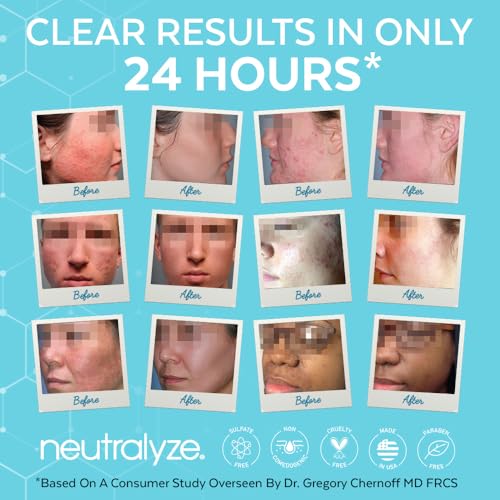 Maximum Strength Acne Treatment Kit with Salicylic & Mandelic Acid – 3-Step Clear Skin System