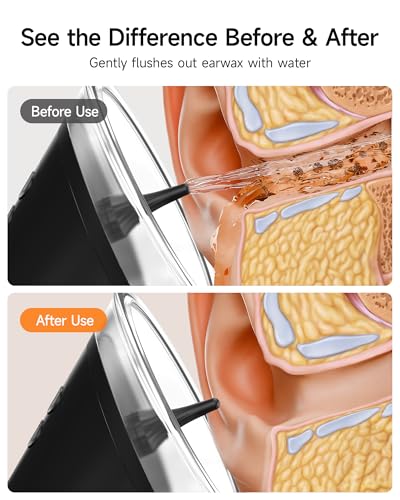 Electric Ear Wax Removal Kit with LED Display & Black & Transparent Nozzles