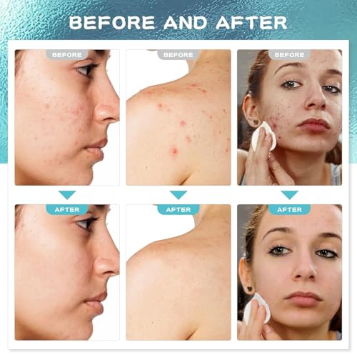 Brightening Vitamin C Face Serum Anti Aging Eye Serum | Fragrance Free Potent Vitamin C Face Moisturizer Facial Serum For Women, Acne, Dark Spot Treatment, Wrinkles, Uneven Skin Tone, 2 Fl Oz