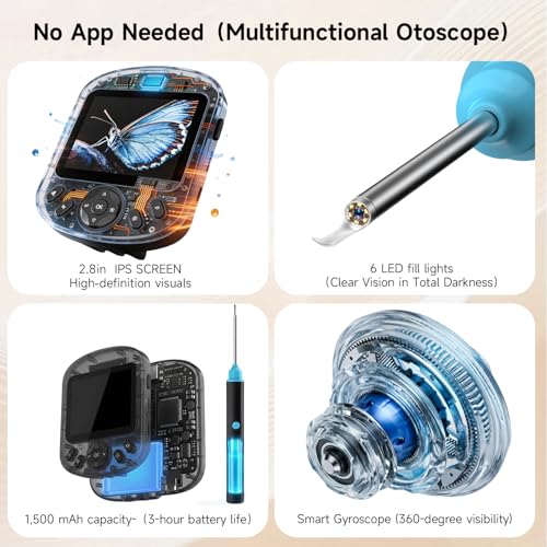Cklvu Smart Digital Otoscope Ear Camera with 2.8" Screen – Plug & Play, Black (Variation: Black)