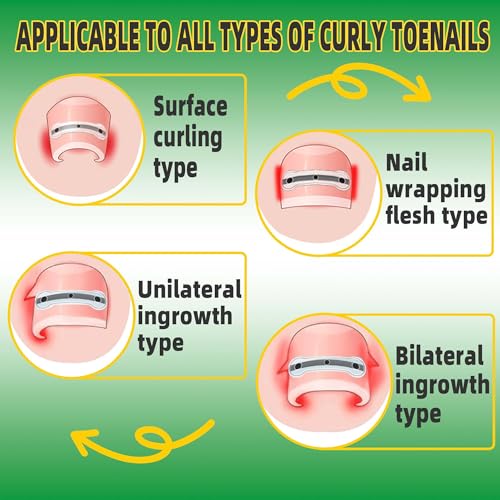 Ingrown Toenail Treatment Kit, Titanium Alloy Ingrown Toenail Removal Kit, Nails Corrector Tool & Remover Strips - Ingrown Toe Nail Quick Relief