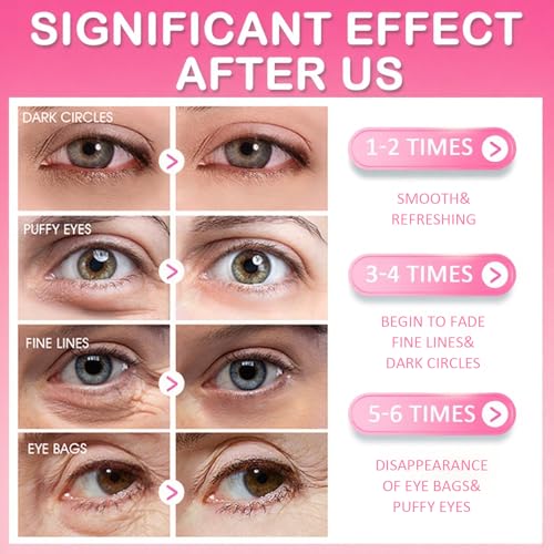 Sulily 30 Pairs Lip Mask & Under Eye Patches, Pink Collagen Hydrogel Eye Patch, Eye Mask Pink Pads, Bulk Gifts, Party Favors, Small Gifts, Gifts for Women, Birthday Gifts for Women, Mothers Day Gifts