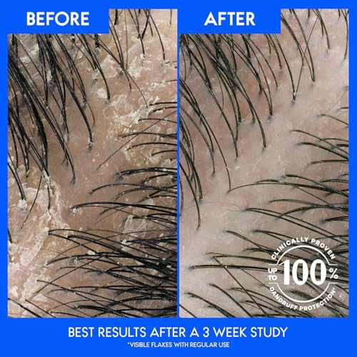 Head & Shoulders Dry Scalp Care Anti-Dandruff Shampoo Twin Pack with Almond Oil - 2 x 32.1 fl oz