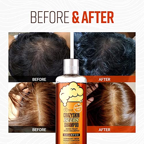 German Beer Yeast Hair Growth Shampoo - 10.15 Fl Oz Pack of 2, Biotin & Natural DHT Blockers, Sulfate-Free, All Hair Types