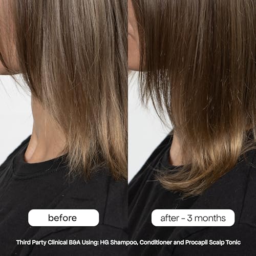 Bondiboost HG Anti-Thinning Shampoo - 16.9 Fl Oz for Thinning Hair - Men & Women