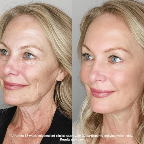 LeVaye Vitamin C Serum for Face Anti-Aging Brightening & Wrinkle Reduction