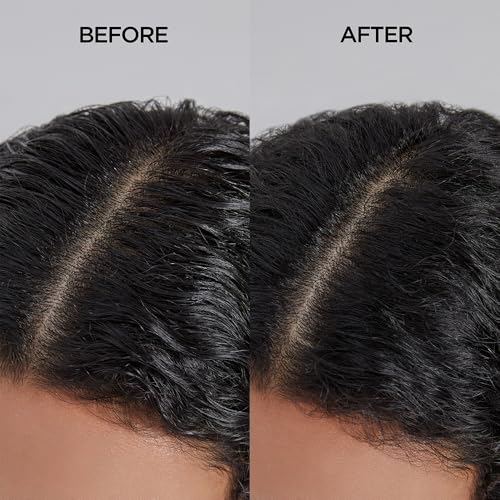 Refreshing Scalp Shampoo for Oily Hair - Cooling & Purifying 11.8oz - Anti-Dandruff, Salon Quality