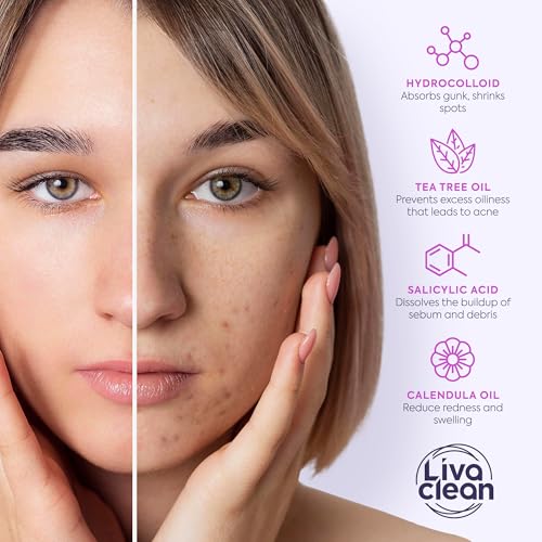 The Ordinary Salicylic Acid 2% Anhydrous Solution, Gentle Exfoliating Serum for Blemish-Prone Skin and Uneven Texture
