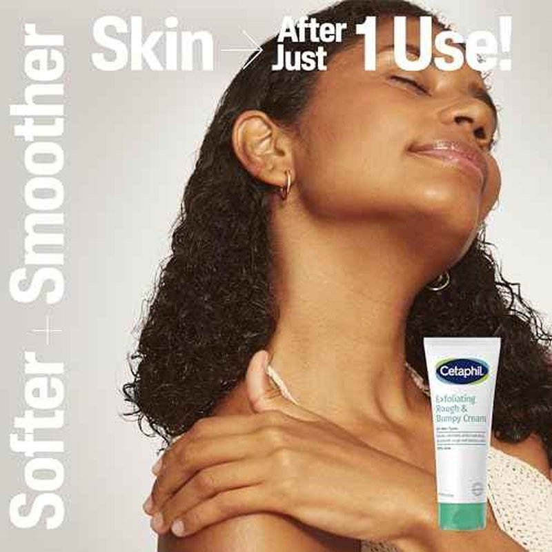 Cetaphil Exfoliating Rough & Bumpy Cream, Lightweight Cream for All Skin Types, 8 oz Tube, 20% Urea, Gently Exfoliates, Refines Skin Texture, Dermatologist Recommended Brand