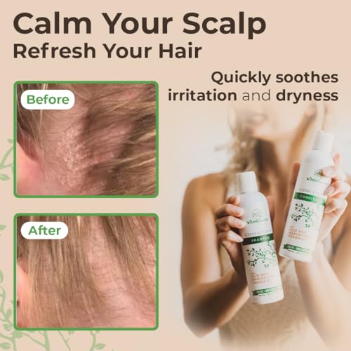 Wild Naturals Anti-Dandruff & Seborrheic Dermatitis Shampoo & Conditioner Set - 16 Fl Oz Pack of 2 for Dry Itchy Scalp