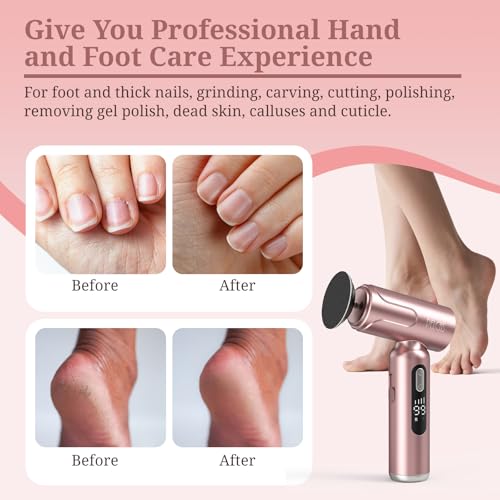 Pelcas Electric Foot Callus Remover with LED Screen & 2-in-1 Pedicure Kit