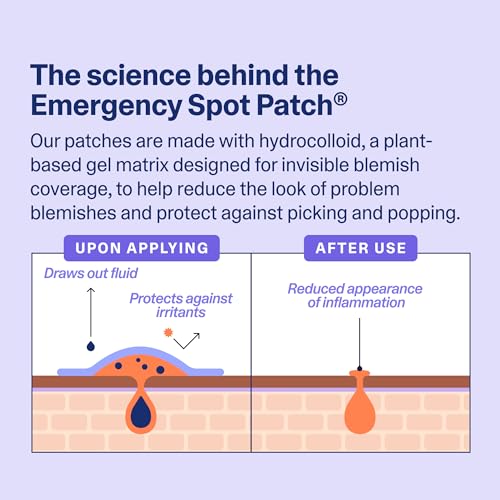 Curology Emergency Spot Pimple Patches for Face, Hydrocolloid Pimple Patches Fast-Acting Support, Spot Concealing and Oil Absorbing, 120 Count