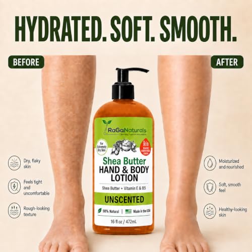 Unscented Shea Butter Lotion for Extremely Dry Skin - 16oz, Fragrance-Free