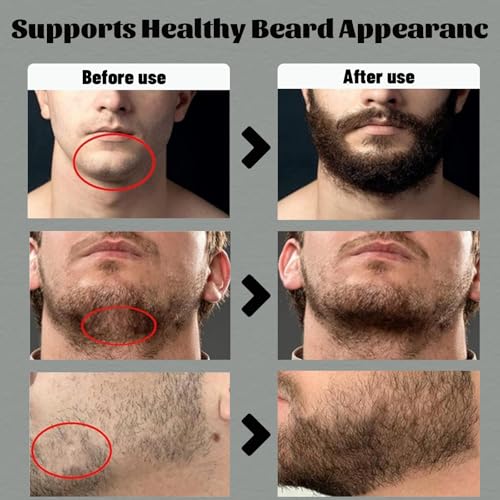 Beard Balm for Men 2PCS - Shea Moisture Beard Growth Vitamins & Stimulating Oil