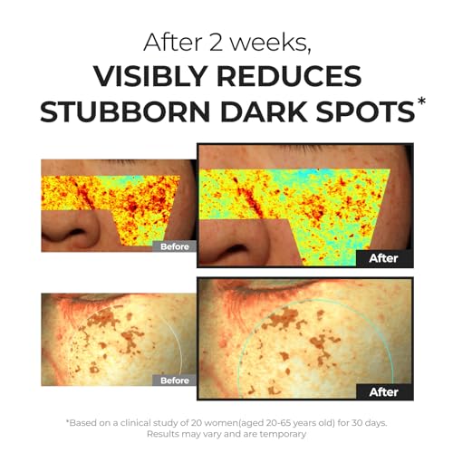 Hyper P-Toning Serum for Brightening & Dark Spot Reduction - 30ml