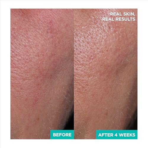 AESTURA A-CICA365 Cooling Relief Toner Pads for Sensitive Skin, 60 Pads