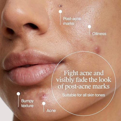 Hydrating Gel Face Wash, Citric Acid + LHA + Glycerin + Beta Glucan, Gentle Cleanser, Oil Free, Sensitive Skin, Dehydrated Skin, Korean Skin Care, Big Size (205ml/6.93 fl oz)