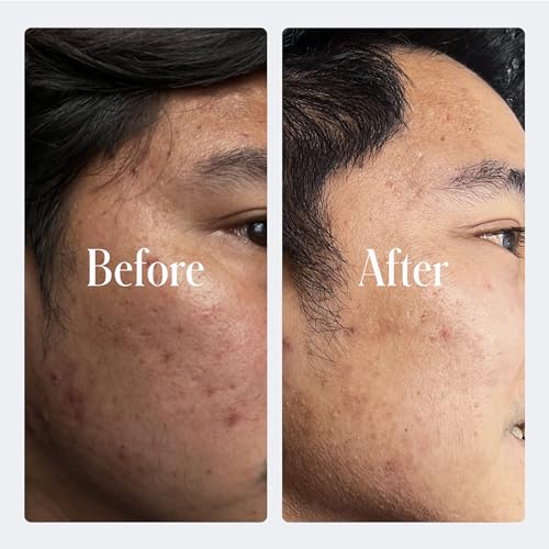 Geologie Ultra Strength Retinol Face Cream - Anti-Aging Night Moisturizer for Men & Women