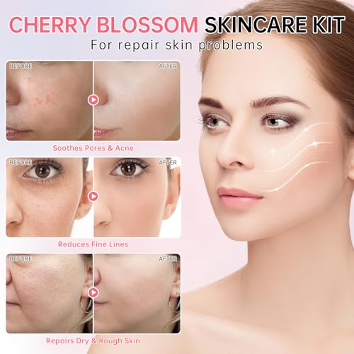 Mopayzer Sakura Skin Care Set for Teen & Women 6 Pcs Moisturizing & Repair