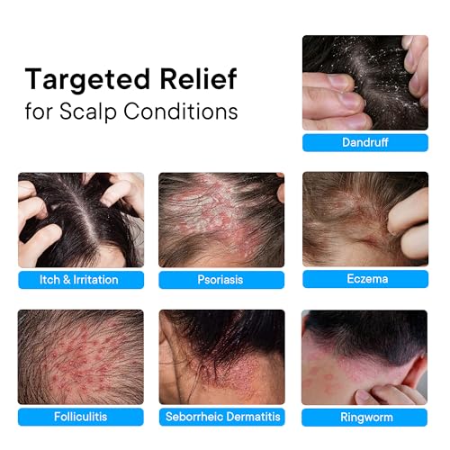 ProBliva 2-Pack Anti Dandruff Shampoo & Scalp Spray Set for Psoriasis & Flaking