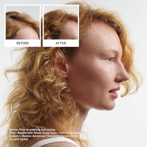 Nioxin Scalp + Hair Thickening System 1 Shampoo| For Natural or Untreated Hair with Light Thinning| With Niacinamide and Biotin| 33.8 Fl oz.