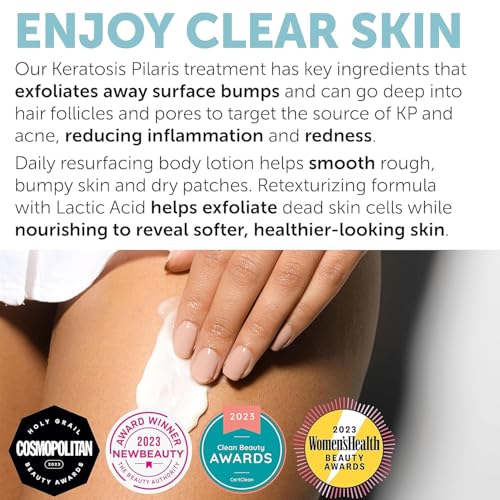 KP Bump Eraser Body Scrub with 10% AHA | Keratosis Pilaris Treatment | Bump Eraser Body Scrub | Ingrown Hair Treatment | Clears Strawberry Legs | Soothes Redness, Dryness & Flaky Skin