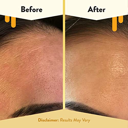 Eczema Honey Nourishing Face Serum - Daily Hydrating Natural Skincare