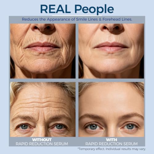 Rapid Reduction Eye Serum 0.33 Fl Oz - Reduces Under-Eye Bags Wrinkles Dark Circles Fine Lines Crow's Feet